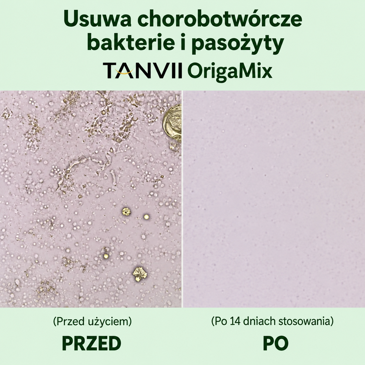 OrigaMix TANVII, aceite de orégano y comino negro en cápsulas