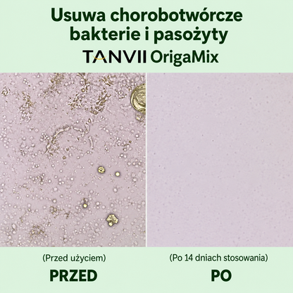 OrigaMix TANVII, aceite de orégano y comino negro en cápsulas